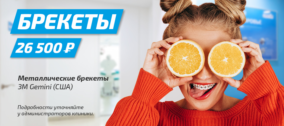 брекеты