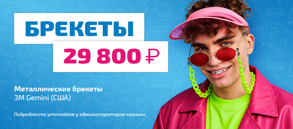 брекеты